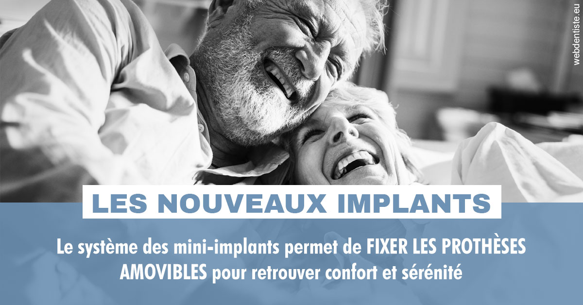 https://www.dentiste-bruxelles-iovleff.be/Les nouveaux implants 2