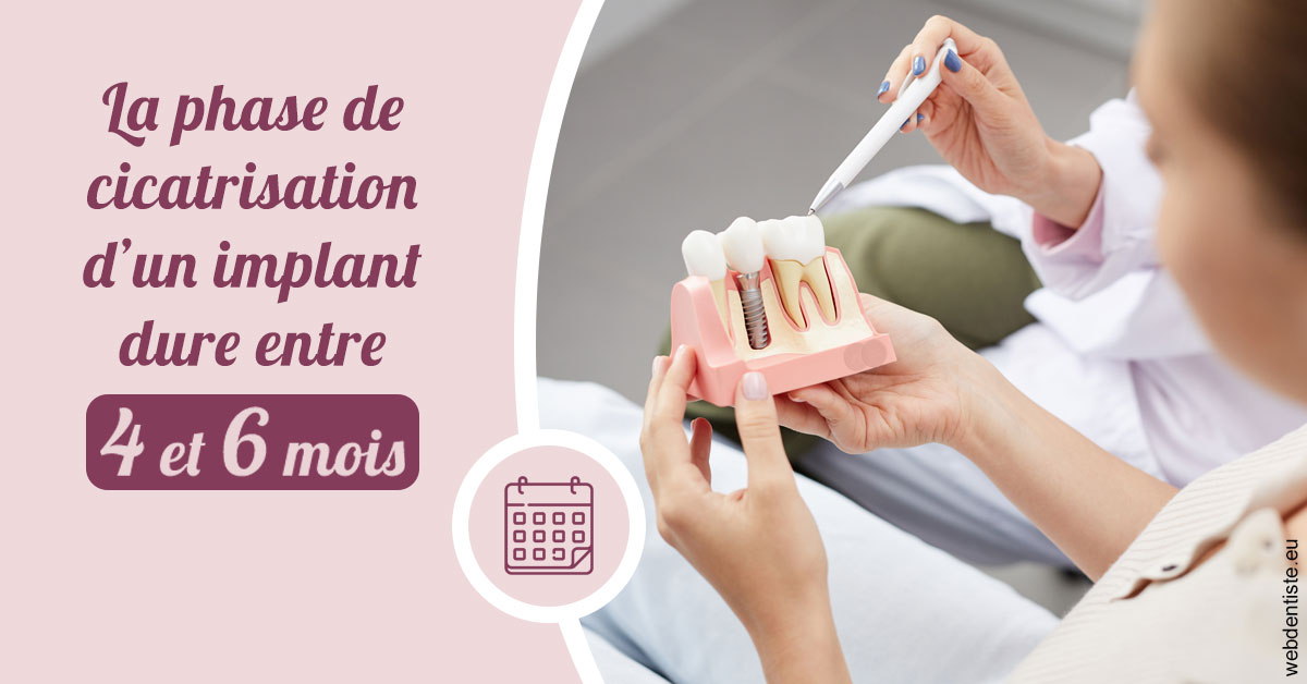 https://www.dentiste-bruxelles-iovleff.be/Cicatrisation implant 2