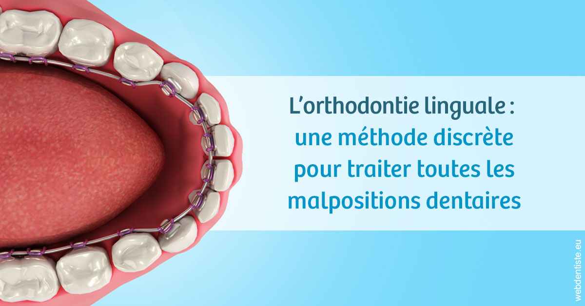 https://www.dentiste-bruxelles-iovleff.be/L'orthodontie linguale 1