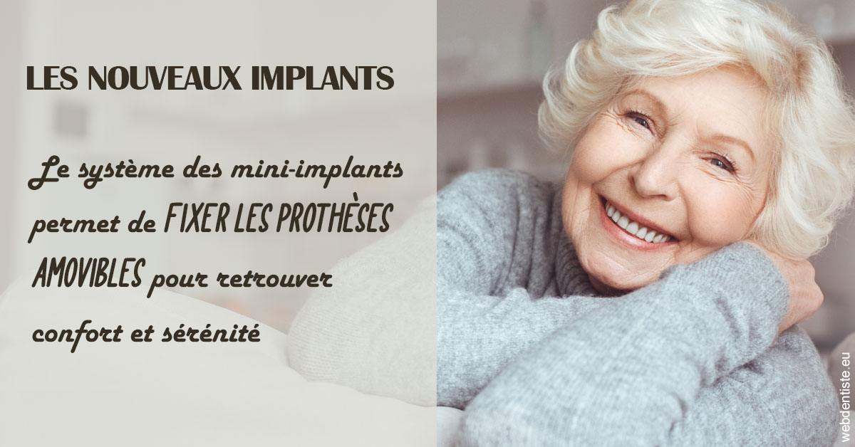 https://www.dentiste-bruxelles-iovleff.be/Les nouveaux implants 1