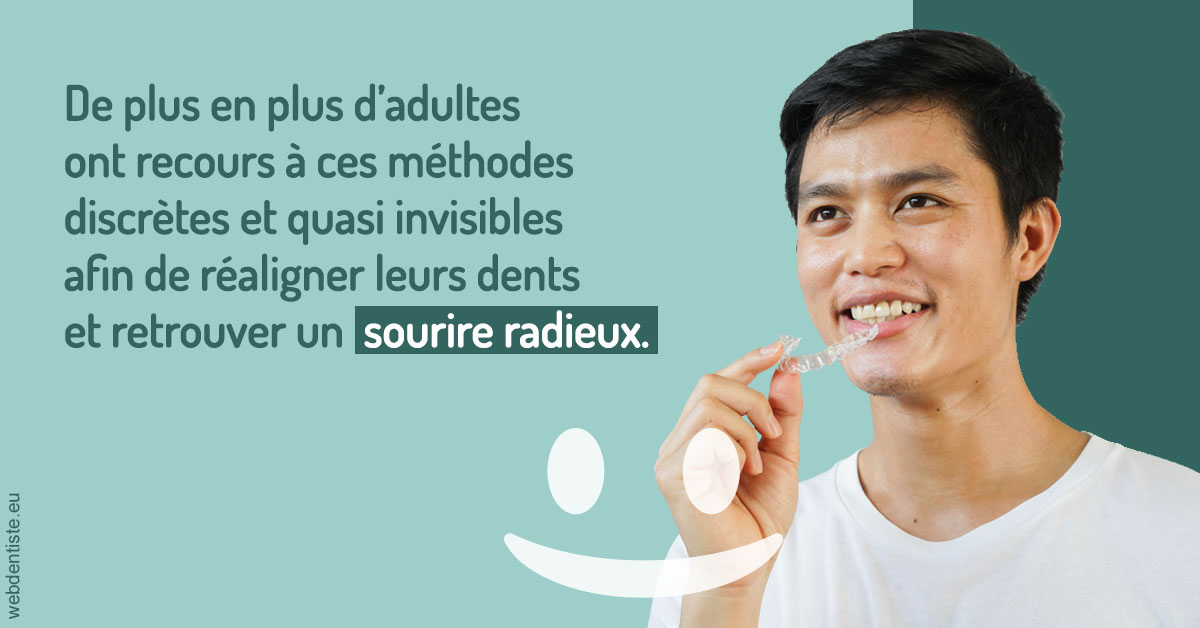 https://www.dentiste-bruxelles-iovleff.be/Gouttières sourire radieux 2