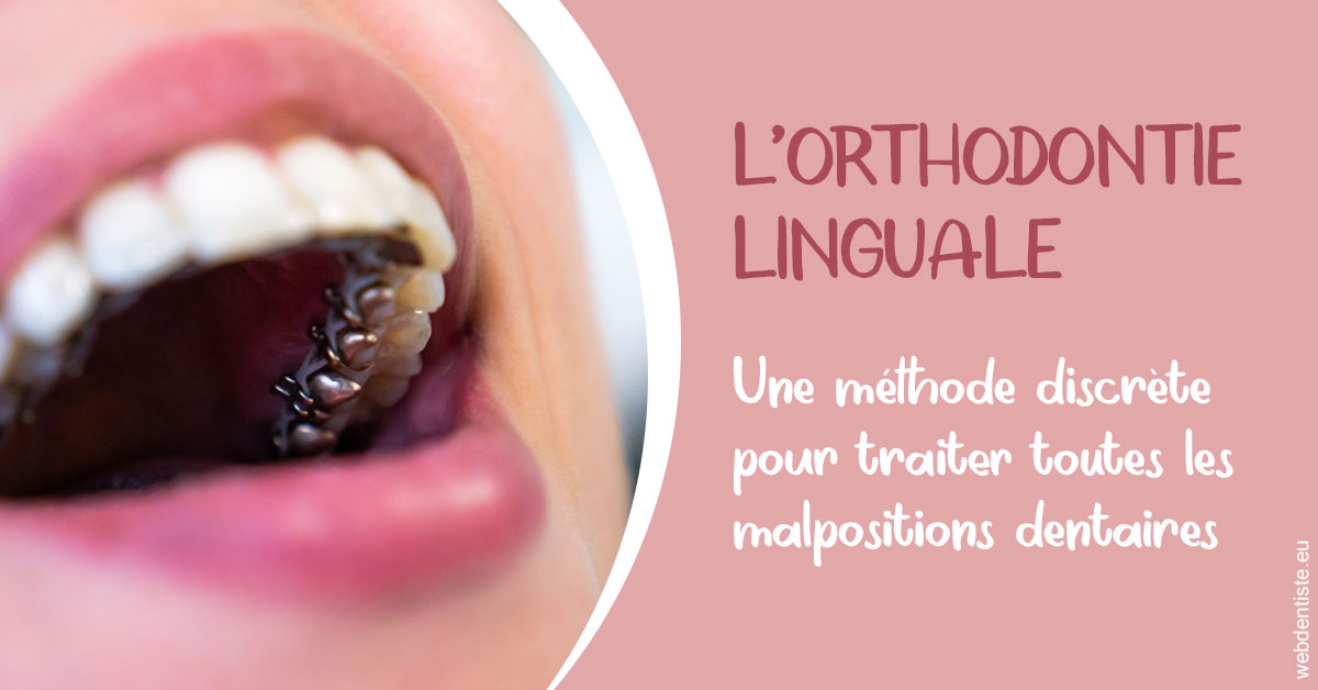 https://www.dentiste-bruxelles-iovleff.be/L'orthodontie linguale 2