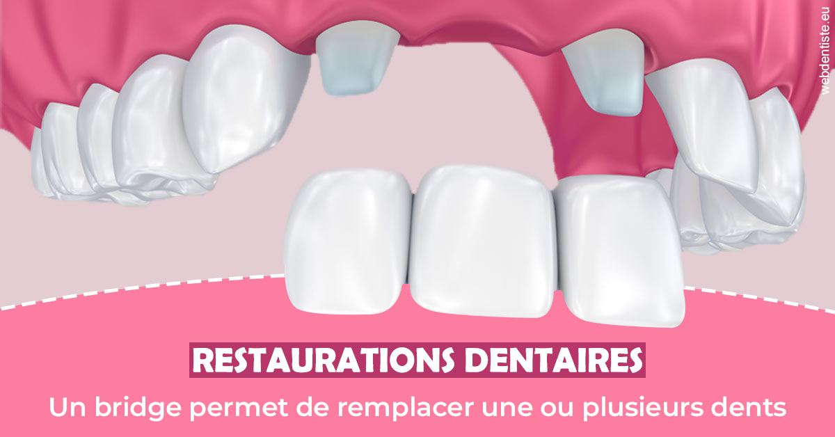 https://www.dentiste-bruxelles-iovleff.be/Bridge remplacer dents 2