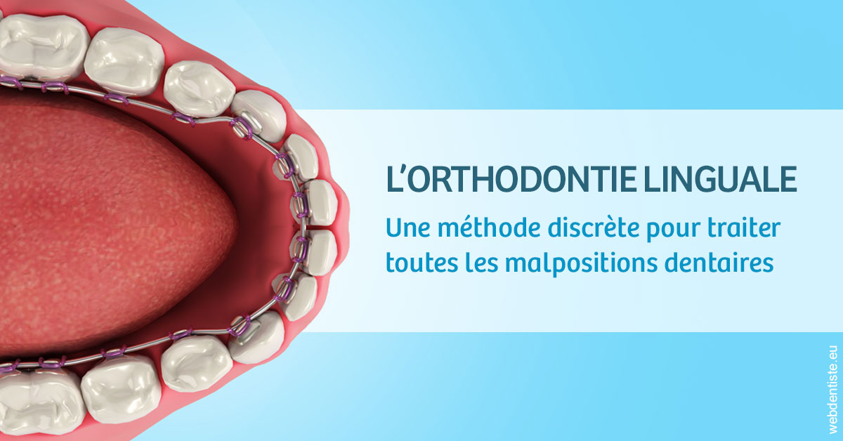https://www.dentiste-bruxelles-iovleff.be/L'orthodontie linguale 1