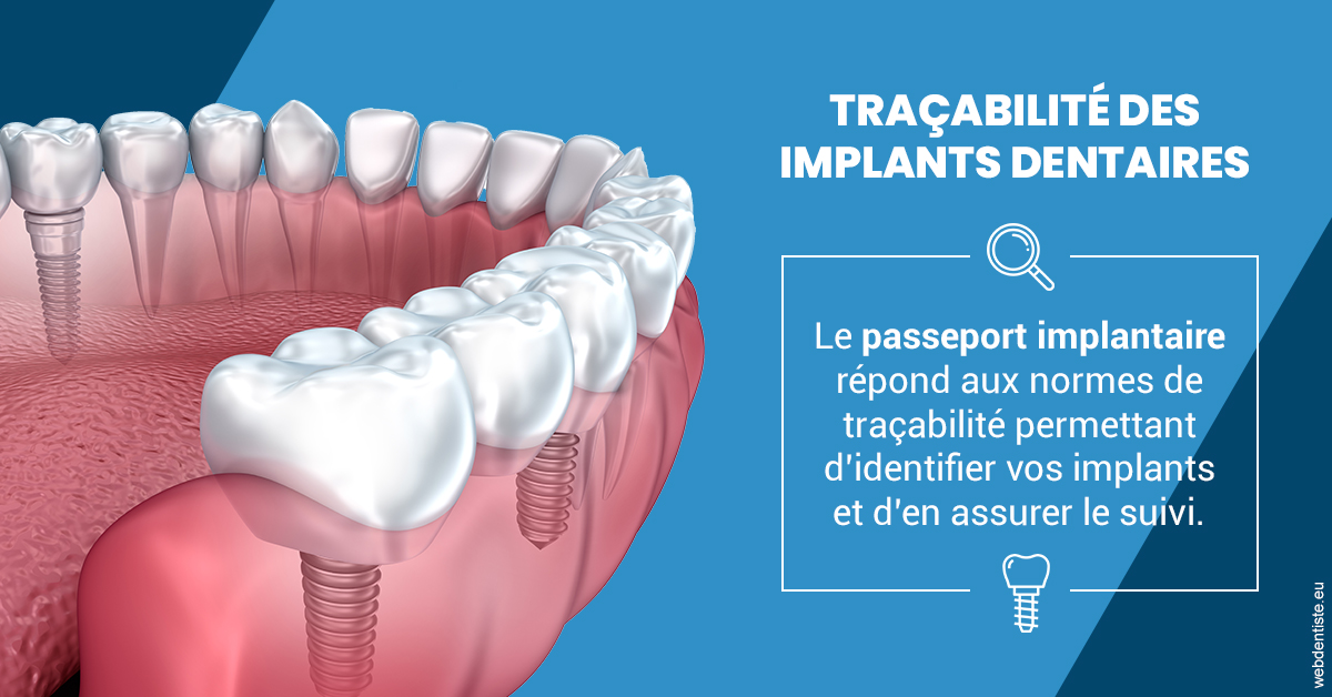 https://www.dentiste-bruxelles-iovleff.be/T2 2023 - Traçabilité des implants 1