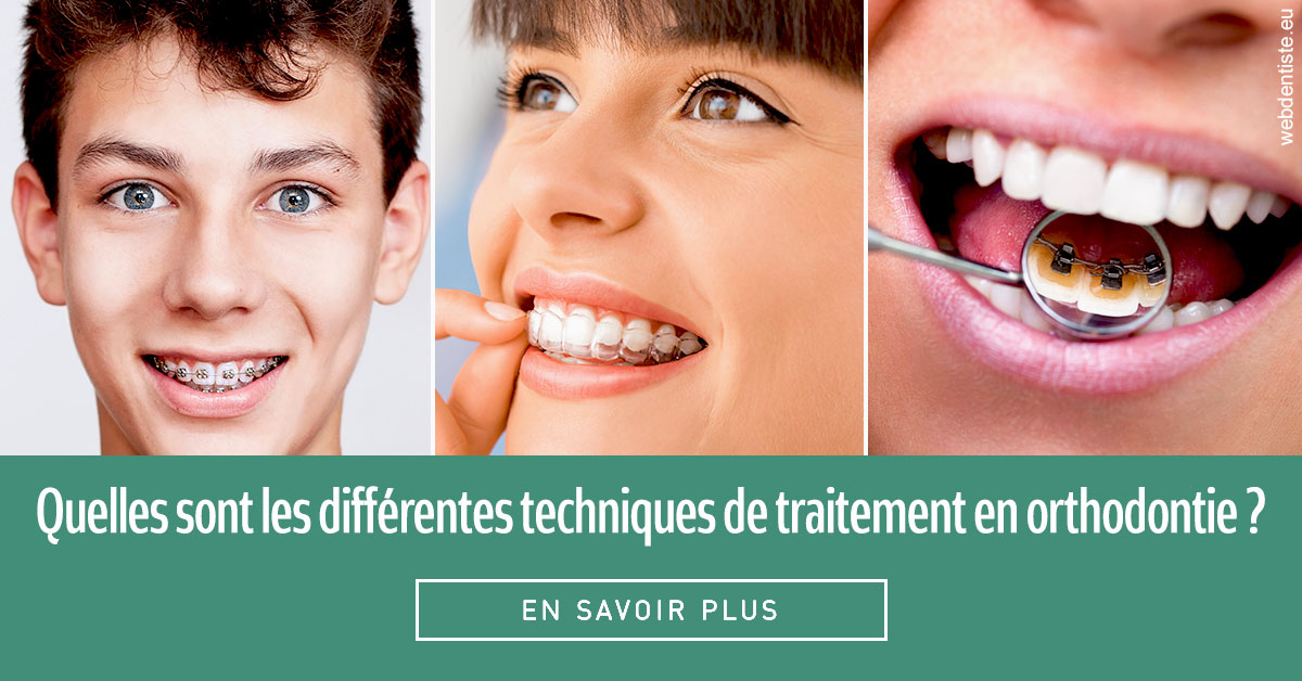 https://www.dentiste-bruxelles-iovleff.be/Les différentes techniques de traitement 2