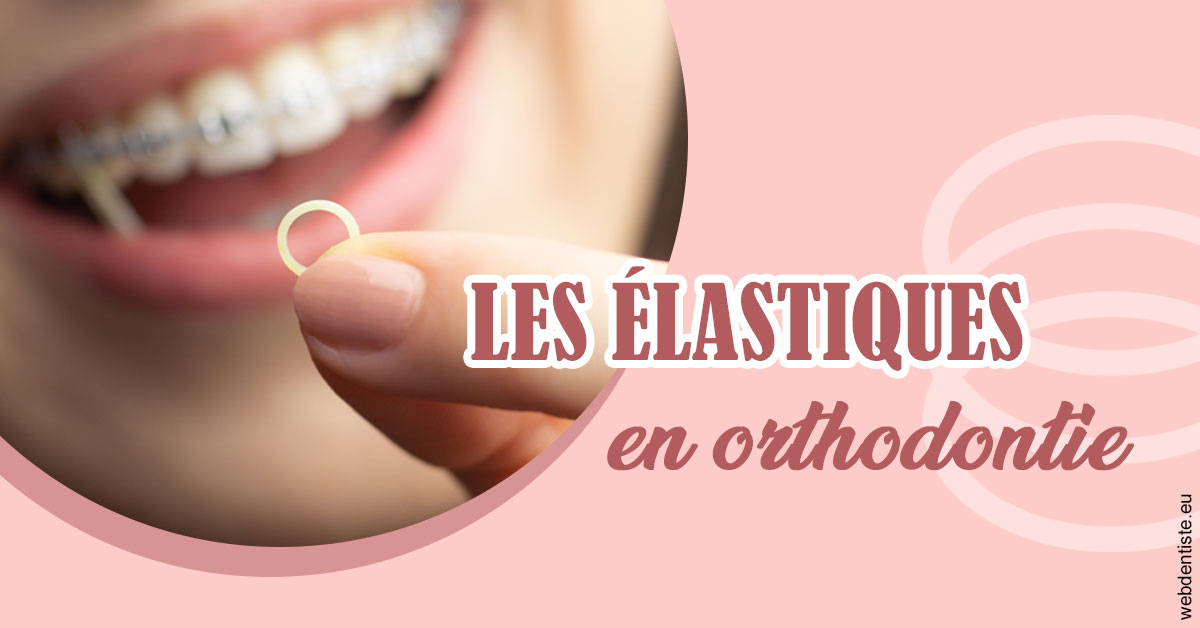 https://www.dentiste-bruxelles-iovleff.be/Elastiques orthodontie 1