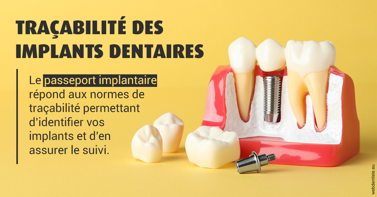 https://www.dentiste-bruxelles-iovleff.be/T2 2023 - Traçabilité des implants 2