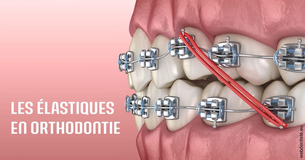 https://www.dentiste-bruxelles-iovleff.be/Elastiques orthodontie 2