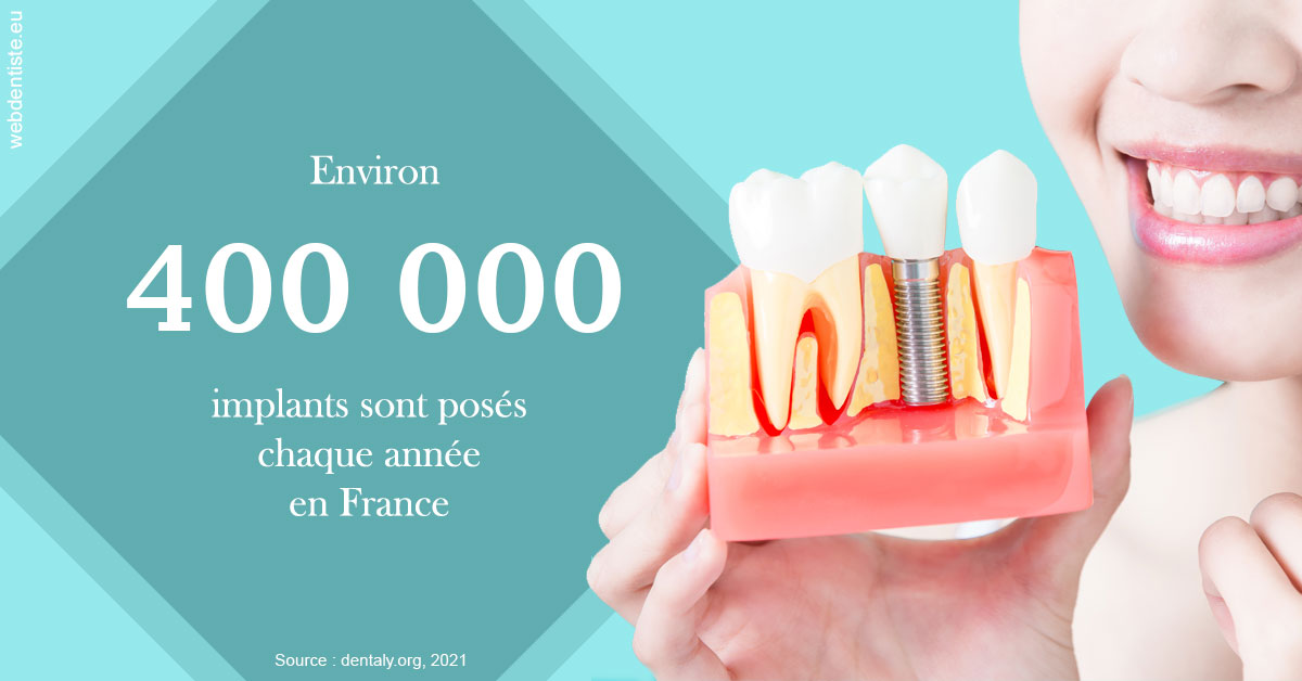 https://www.dentiste-bruxelles-iovleff.be/Pose d'implants en France 2