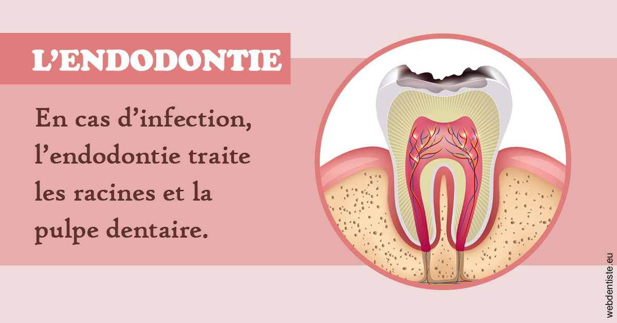 https://www.dentiste-bruxelles-iovleff.be/L'endodontie 2