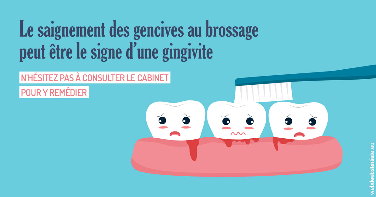 https://www.dentiste-bruxelles-iovleff.be/2023 T4 - Saignement des gencives 02